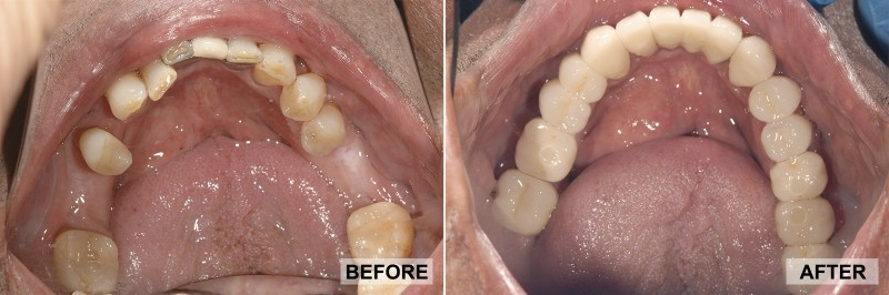 Before and After - Peter 2