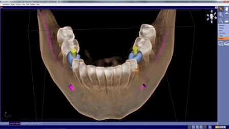 digital dentistry