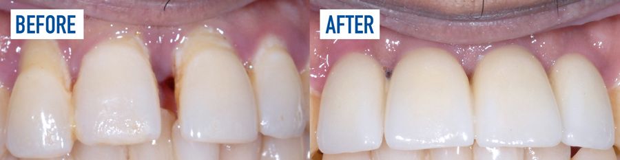 Richard Before & After