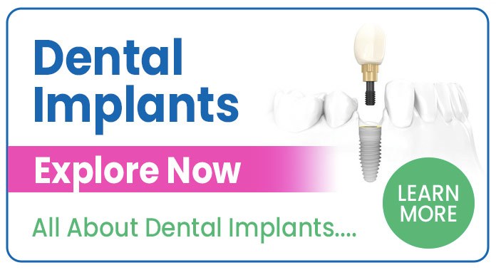 Learn About Dental Implants